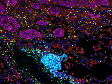 Diagnostic multi-omics development