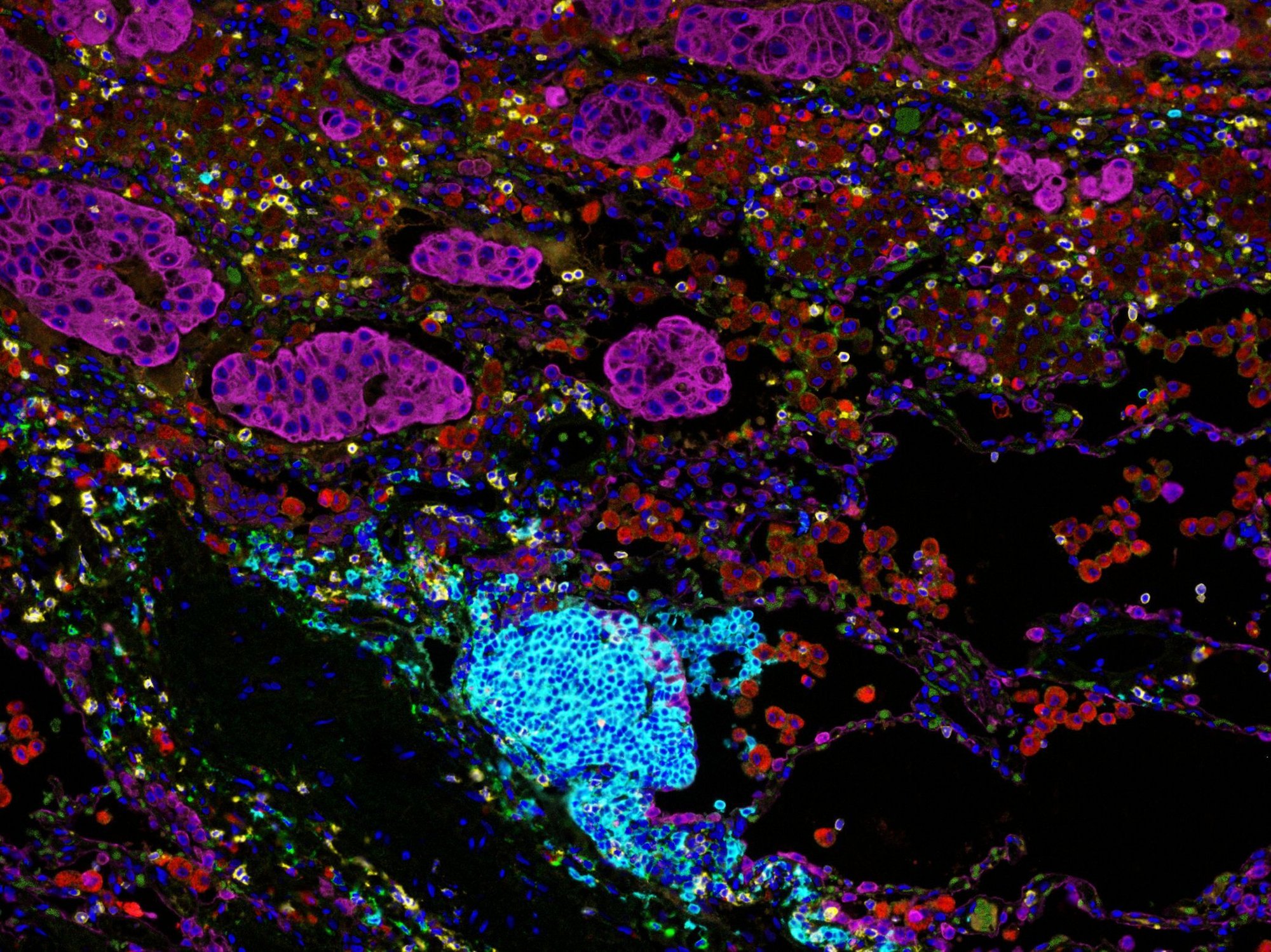 Precision's therapeutics and diagnostic multi-omics development capabilities