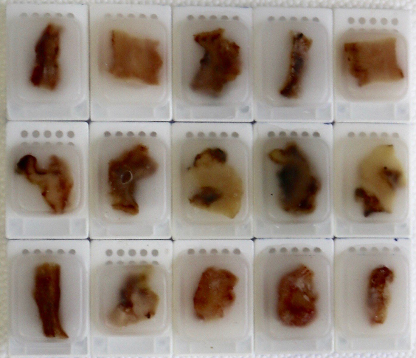 FFPE Tissue Samples | Precision for Medicine