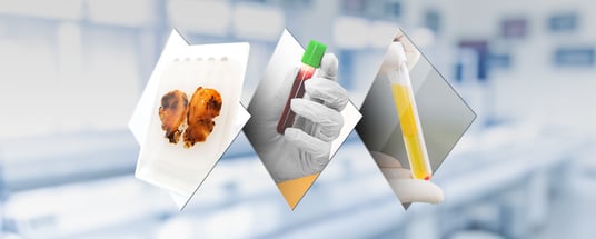 Back to the Source: A Translational Leader on Extending the Living Legacy of Genomic Data