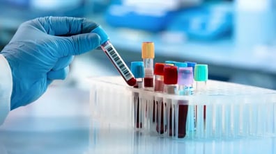 Optimal Sample Type for Flow Cytometry
