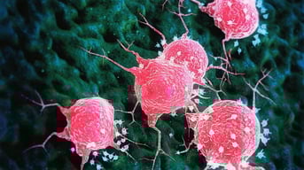 solid tumors