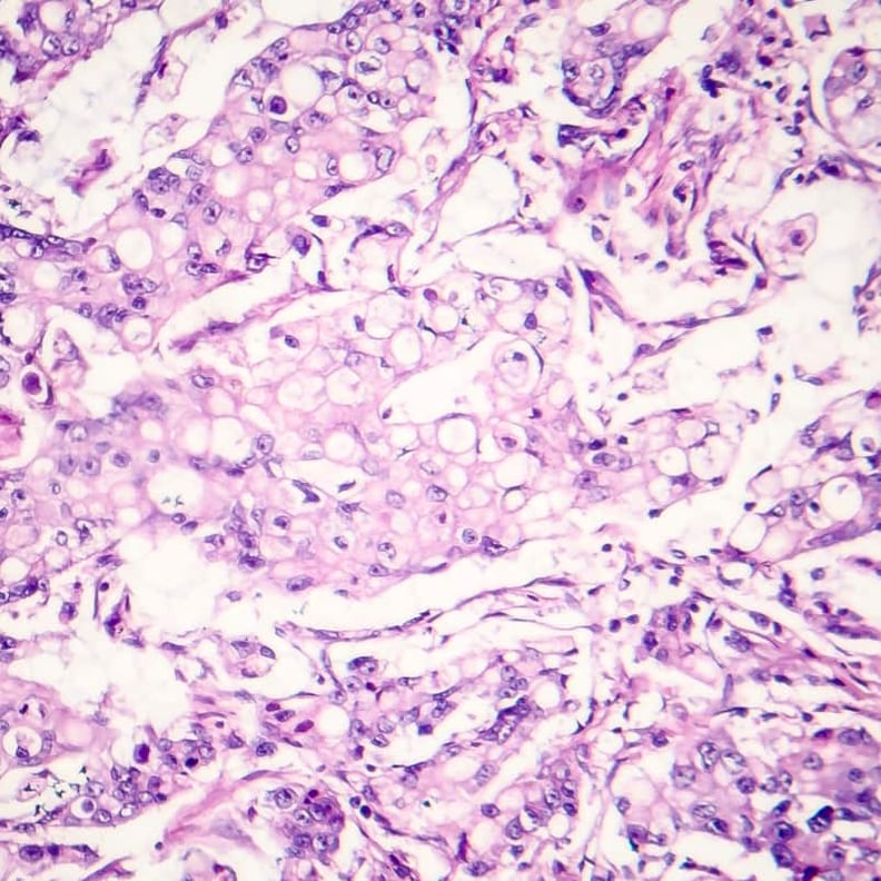 Human Tissue Samples | Precision for Medicine