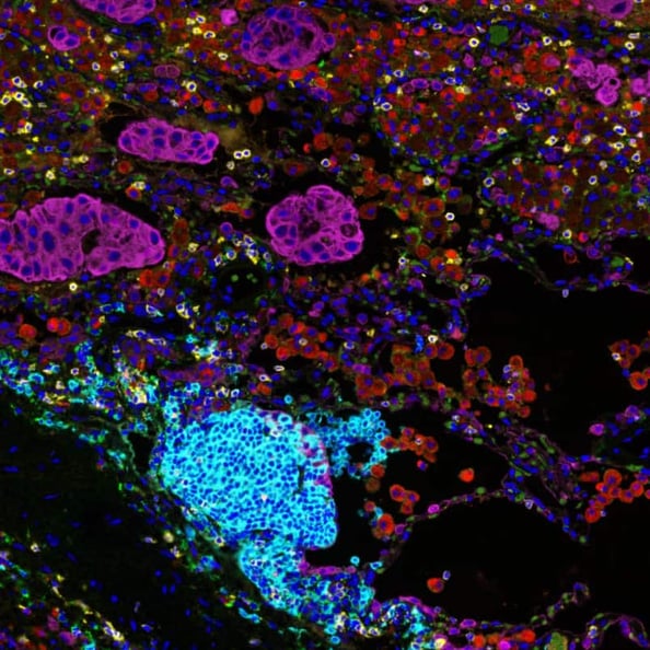 Human Tissue Samples | Precision for Medicine