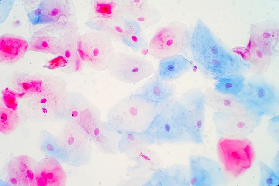 Perishable Tissue Fresh & Frozen Tissue Samples | Precision for Medicine