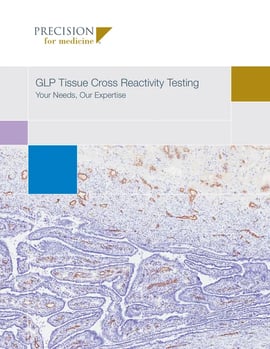 https://5014803.fs1.hubspotusercontent-na1.net/hubfs/5014803/resources/thumb/GLP-Tissue-Cross-Reactivity-Article.webp