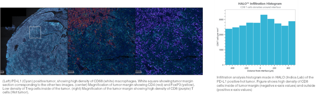 Analysis of the tumor microenvironment via mIF can provide critical information on how a therapeutic is working during clinical trials.